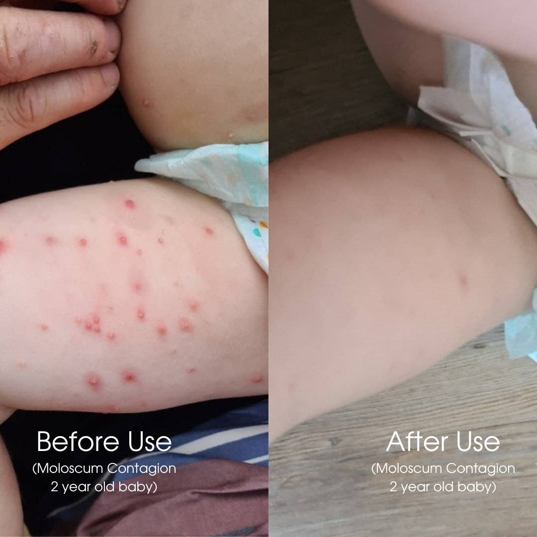 Organic Bottom Balm